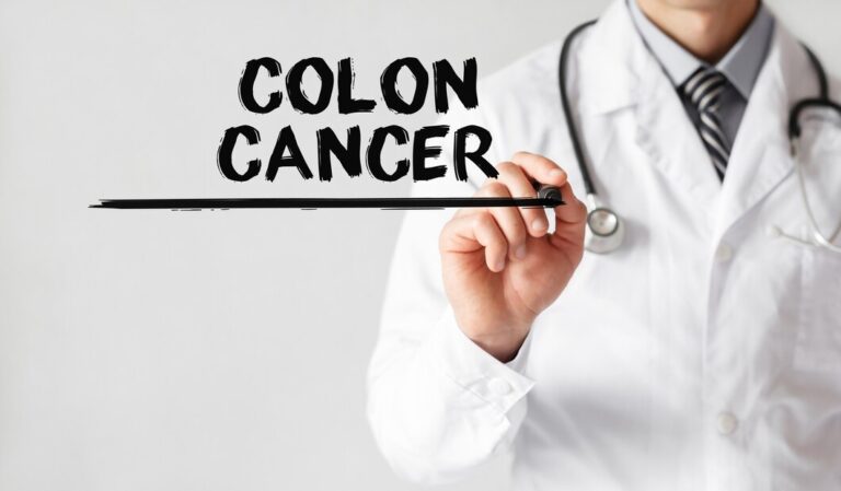 9 Key Lifestyle Changes to Reduce Your Risk of Colon Cancer