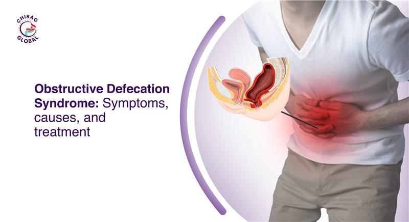 Obstructive Defecation Syndrome: Symptoms, Causes, and Treatment 