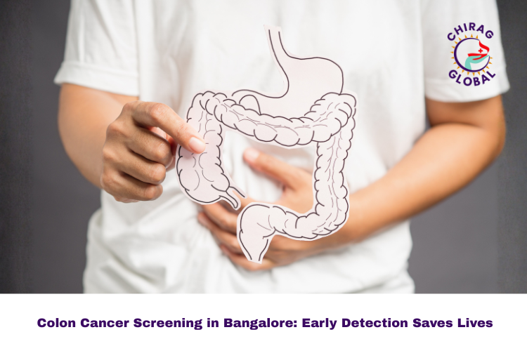 Colon Cancer Screening in Bangalore