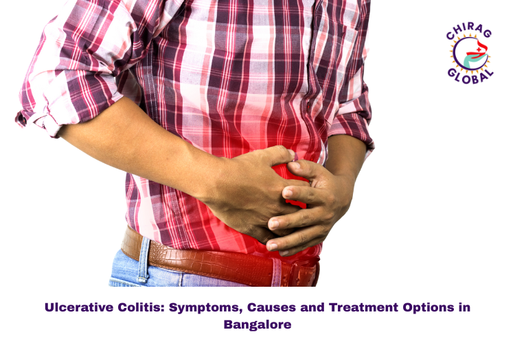 What Is Ulcerative Colitis? Symptoms, Causes, and Overview