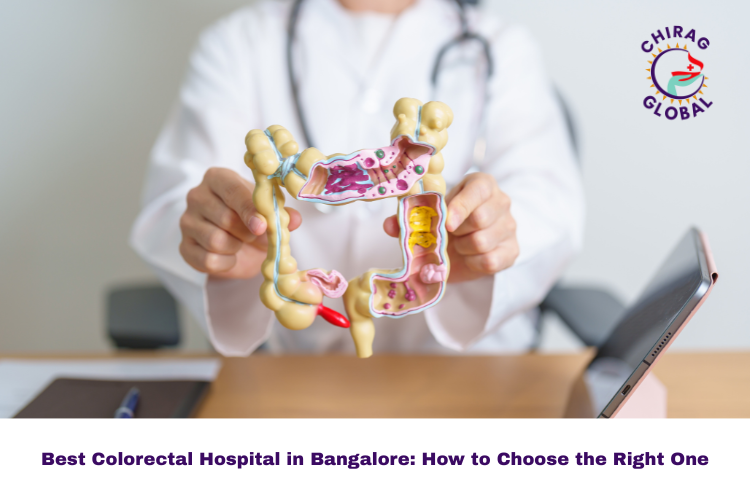 How to Choose the Right Colorectal Hospital in Bangalore: A Simple Checklist
