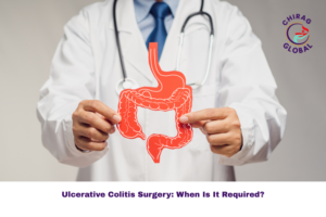 Ulcerative Colitis Surgery