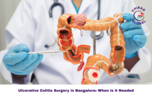 Ulcerative Colitis Surgery in Bangalore