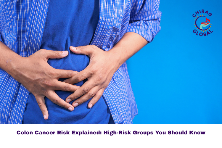 Colon Cancer Risk: Who Is at High Risk?