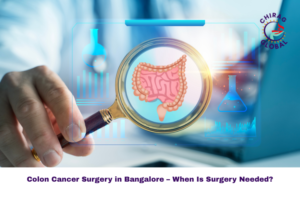 Colon cancer surgery