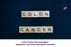 Colon Cancer Early Signs