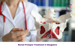 Rectal Prolapse Treatment in Bangalore