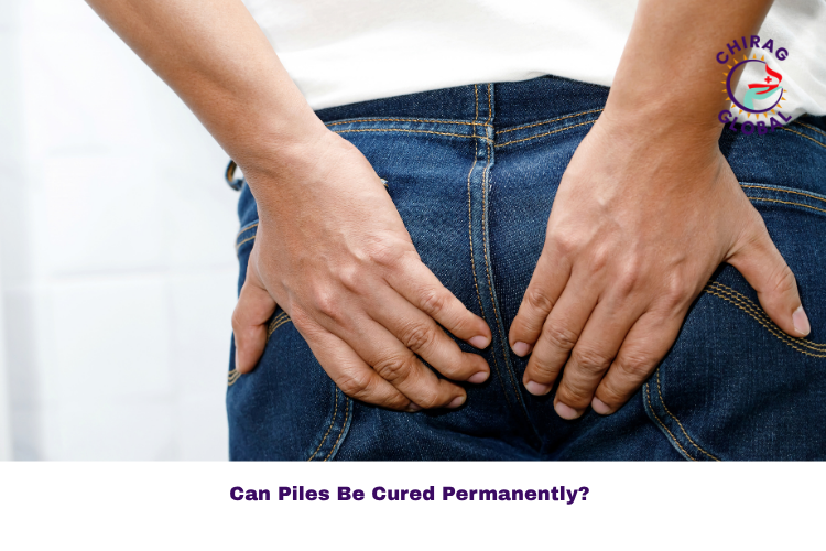 Can Piles Be Cured Permanently